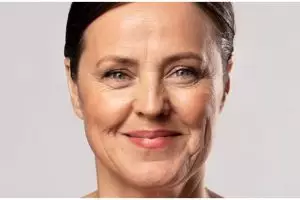 Tak perlu pakai mentimun, ini trik kencangkan dan lembapkan kulit wajah pakai 1 jenis karbohidrat