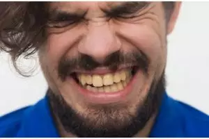 Bukan gunakan baking soda, ini trik lunturkan noda kuning pada gigi hanya pakai 1 bahan dapur