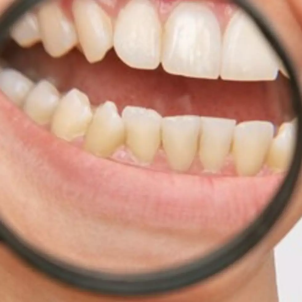 Tak pakai kulit pisang, ini cara memutihkan gigi penuh noda kuning dengan 1 bahan dapur