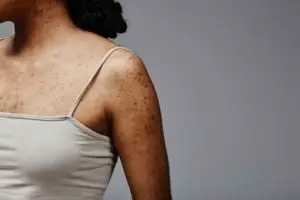 Tanpa body serum pencerah, ini trik memutihkan kulit kusam akibat panas-panasan pakai 1 jenis buah