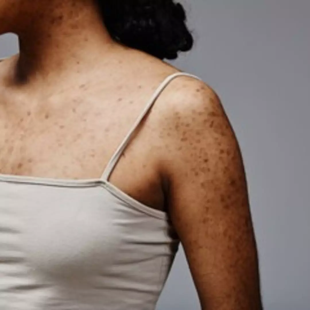 Tanpa body serum pencerah, ini trik memutihkan kulit kusam akibat panas-panasan pakai 1 jenis buah