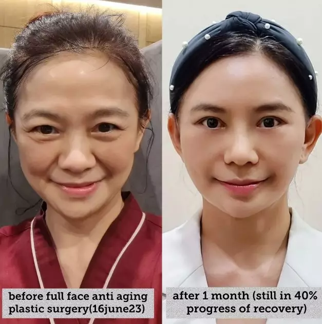 alasan nenek Puspa Dewi jalani oplas © berbagai sumber alasan nenek Puspa Dewi jalani oplas © berbagai sumber