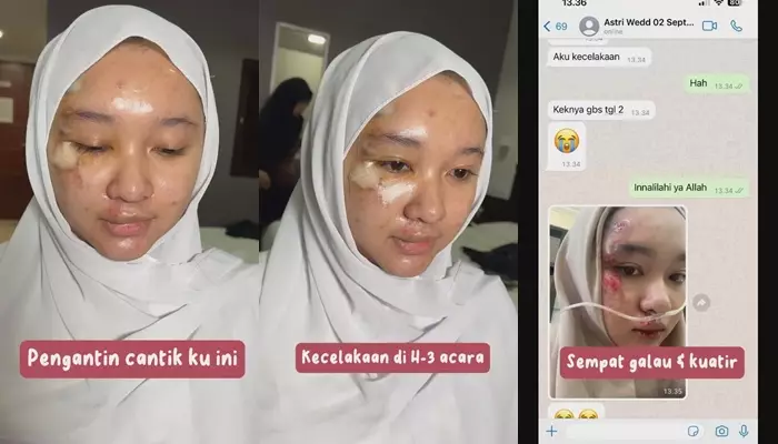 pengantin kecelakaan dirias tetap manglingi © 2023 brilio.net