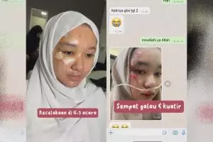 Alami kecelakaan H-3 menikah, pengantin dimakeup MUA ini tetap manglingi meski wajah penuh lecet