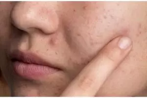 Bukan dengan gula pasir, ini cara menghaluskan tekstur kulit kasar pakai masker dari 1 bahan makanan