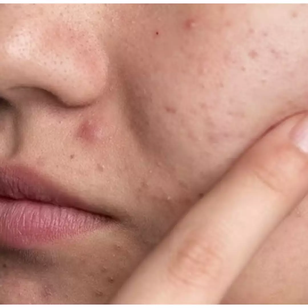 Bukan dengan gula pasir, ini cara menghaluskan tekstur kulit kasar pakai masker dari 1 bahan makanan