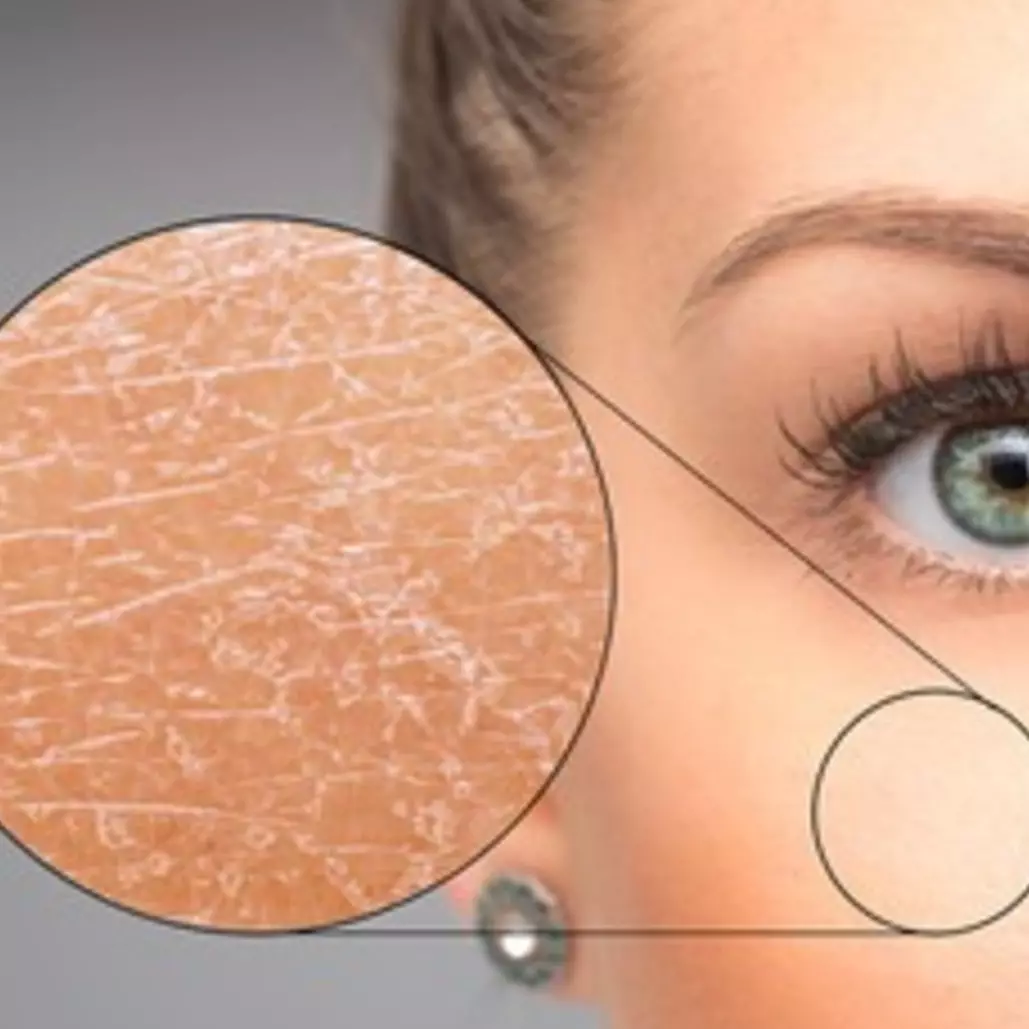 Tak perlu madu, ini trik bikin kulit bebas kering seharian walau di ruang ber-AC pakai 1 jenis kacang