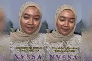 Jerawatan di hari pernikahan gegara salah pakai krim, MUA ini rias pengantin jadi mulus bak porselen