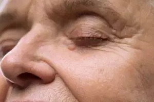 Bukan pakai susu, ini cara atasi keriput agar wajah kembali kenyal hanya dengan 1 bahan dapur