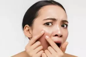 Bukan pakai tomat, ini cara kurangi minyak wajah penyebab pori-pori tersumbat dengan 1 jenis protein