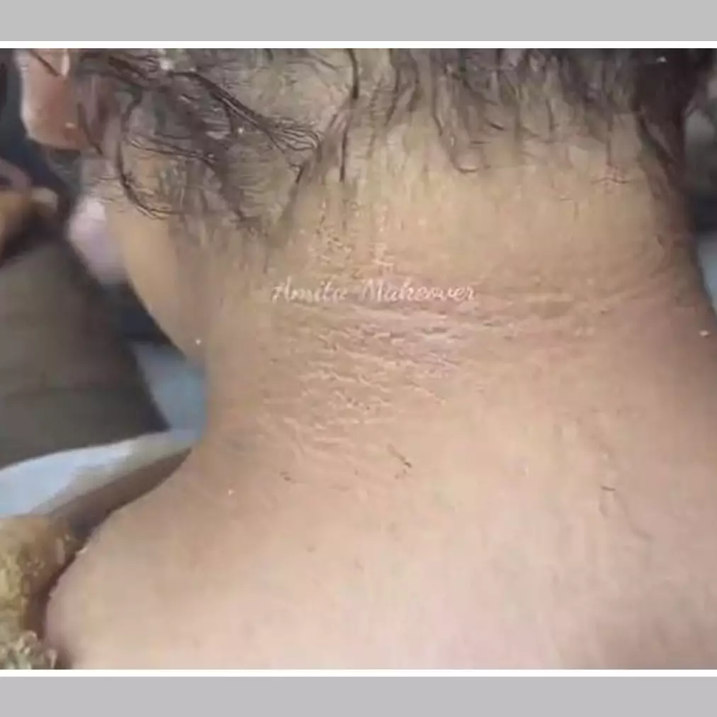 Tak perlu digosok kentang, ini trik hilangkan garis halus dan noda hitam di leher pakai 1 jenis bunga