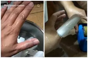 Tanpa pasta gigi, ini trik atasi kulit kena air atau minyak panas biar tak melepuh pakai 1 bahan dapur