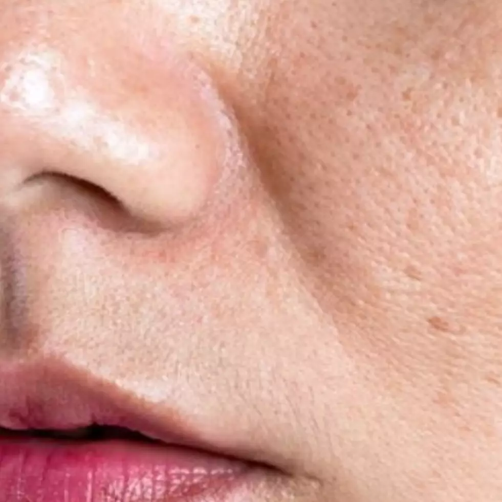 Tak hanya air mawar, ini trik cerahkan flek hitam dan wajah kusam dengan tambahan 1 jenis buah-buahan