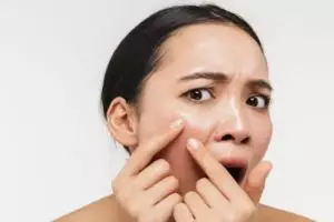 Nggak perlu lemon, ini trik cegah komedo dan pori besar pada wajah berminyak pakai 1 jenis sari buah