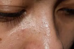 Bukan air mawar, ini cara bikin pori-pori kulit rapat dan bebas minyak seharian pakai 1 jenis bunga