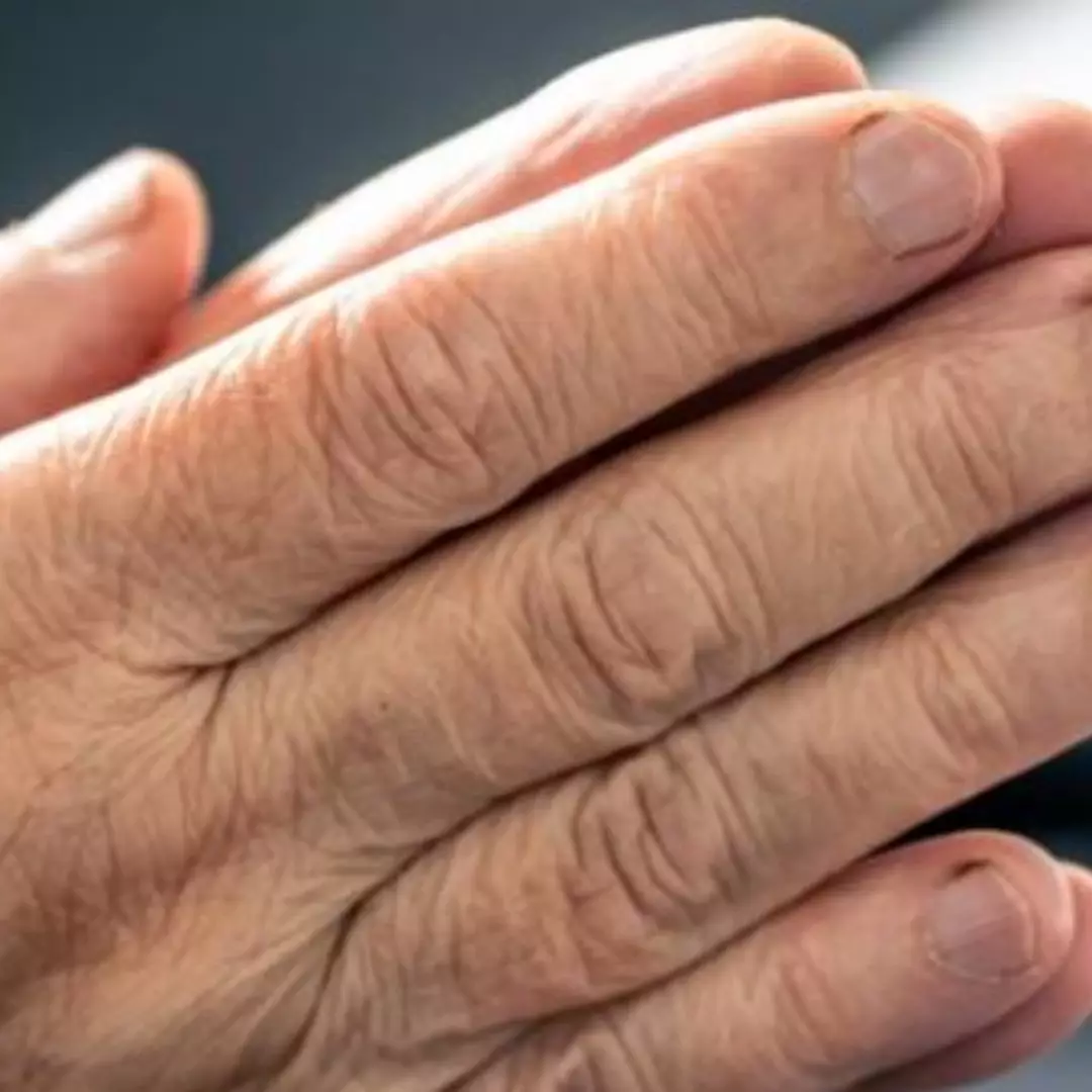 Tanpa tambahan petroleum jelly, begini trik bikin tangan halus bebas kerutan pakai 1 jenis buah-buahan