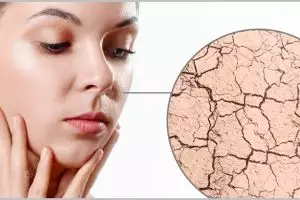 Nggak perlu madu, ini cara mudah atasi kulit kering agar kembali lembap hanya pakai 2 bahan alami