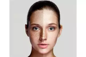 Putih cerah tanpa susu, ini trik basmi noda hitam di wajah kusam pakai 1 jenis umbi-umbian