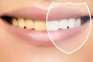 Bukan pakai baking soda, begini trik hilangkan plak dan bau mulut pada gigi hanya pakai 2 bahan alami