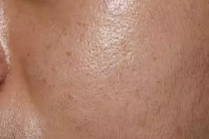 Tak ribet touch-up bedak, ini trik samarkan pori-pori agar wajah bebas minyak pakai 1 jenis minuman