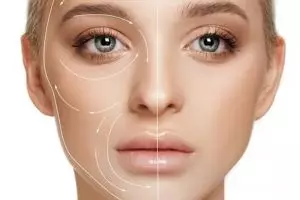 Tak perlu almon dan jahe, ini trik lenyapkan garis halus pakai krim dari 1 jenis karbohidrat