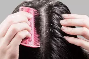 Tanpa tambahan minyak kelapa, ini trik atasi rambut berketombe pakai 1 jenis biji-bijian