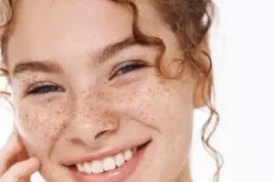 Wajah mulus antinoda, ini trik pudarkan flek hitam pada wajah tanpa laser dengan 2 jenis buah-buahan