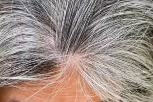 Nggak perlu pakai jintan, ini cara menghitamkan uban tanpa semir hanya dengan 3 bahan dapur