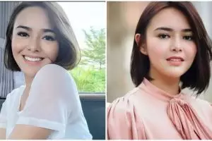 Cerita Amanda Manopo blak-blakan ngaku punya penyakit epilepsi, sering kejang hingga nyaris meninggal