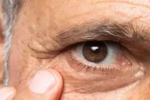 Kulit jadi kencang tampak 10 tahun lebih muda, ini trik atasi keriput area mata pakai 1 bahan makanan