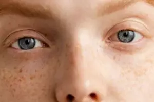 Tanpa gunakan lemon dan kunyit, ini cara memudarkan pigmentasi agar kembali cerah pakai 2 jenis daun