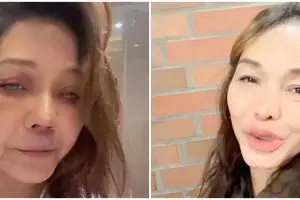 Penampilan Bunda Corla usai operasi plastik disebut Angelina Jolie versi Indonesia, intip 7 potretnya