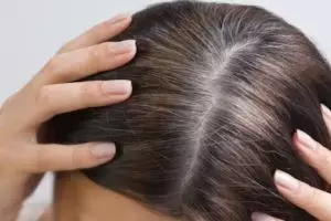 Tak cuma pakai minyak kelapa, ini cara bikin uban jadi kembali hitam dengan tambahan 1 jenis rempah