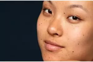 Tanpa teh hijau, ini cara cerahkan flek hitam di wajah akibat paparan sinar biru pakai 1 ekstrak buah