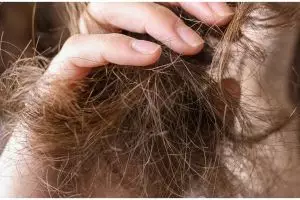 Tak perlu dipotong, ini cara optimalkan sampo untuk atasi rambut bercabang pakai 1 bumbu dapur