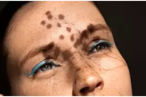 Tak cuma lemon, ini cara cerahkan flek hitam yang menyebar di wajah pakai 1 bahan minuman