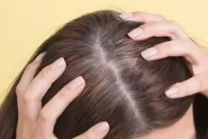 Tak cuma pakai cengkeh, begini cara cegah tumbuhnya uban prematur dengan tambahan 1 jenis sampah dapur