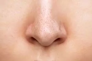 Tak perlu beli pore pack, ini trik bersihkan komedo hitam area hidung pakai 1 bahan dapur