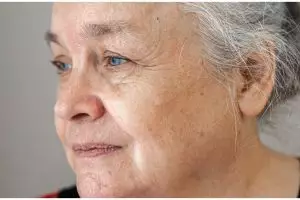 Tanpa teh hijau dan lemon, ini trik bikin wajah bebas flek hitam dan kerutan hanya pakai 1 umbi-umbian