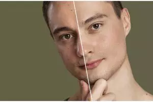 Tanpa gunakan campuran timun, ini trik mengatasi kulit wajah gradakan pakai 1 buah