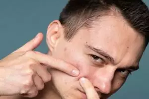 13 Rekomendasi skincare pria untuk atasi jerawat harga di bawah Rp 150 ribu, wajah mulus tanpa noda