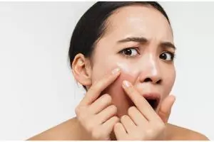 Tanpa ditambah oatmeal, ini trik atasi kulit berminyak agar tak timbul jerawat pakai 1 jenis tepung