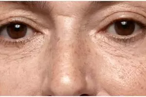 Hilang dalam hitungan jam, ini cara hilangkan bintik hitam di wajah pakai 1 jenis karbo