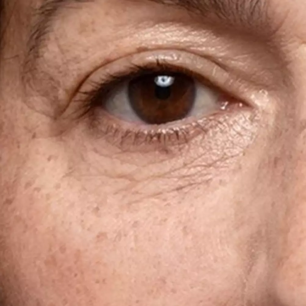 Hilang dalam hitungan jam, ini cara hilangkan bintik hitam di wajah pakai 1 jenis karbo