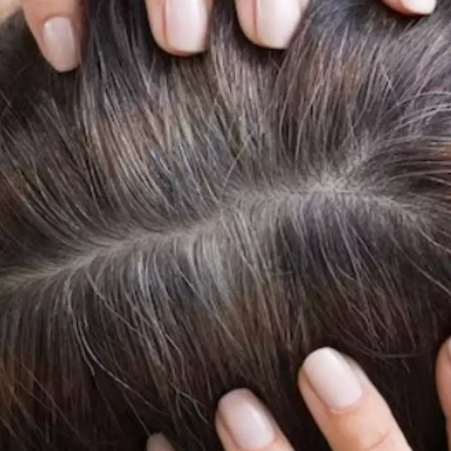 Hitam merata tanpa rambut putih, ini cara mengurangi tumbuhnya uban prematur pakai 1 jenis biji-bijian