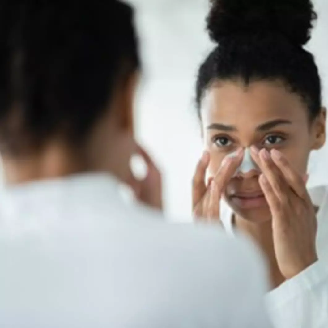 11 Rekomendasi skincare untuk menghilangkan komedo di bawah Rp 250 ribu, wajah mulus bebas kotoran