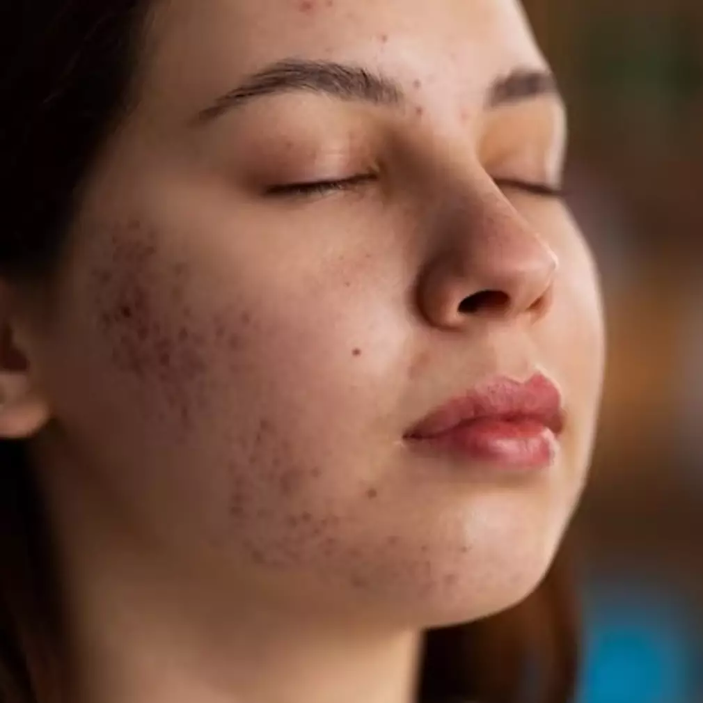 Jangan suntik vitamin, ini trik bikin serum pencerah wajah kusam penuh flek hitam dengan 1 jenis buah