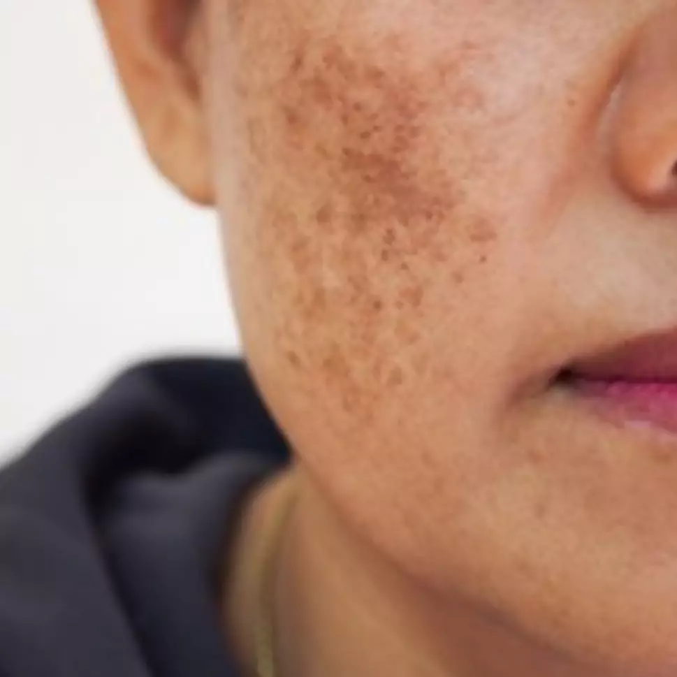 Tanpa bedak dingin, ini trik bikin krim pencerah agar wajah bebas kusam pakai 1 jenis minuman