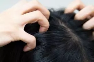 Lebat tanpa hair tonic, ini trik kurangi rontok dan kulit kepala gatal pakai 1 jenis tanaman hias