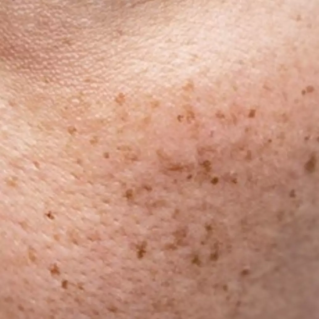 Tanpa beli produknya, ini trik membuat toner pencerah kulit kusam penuh flek hitam pakai 1 air bekas